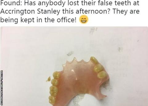 Accrington Stanley lose set of false teeth which were already lost by a fan