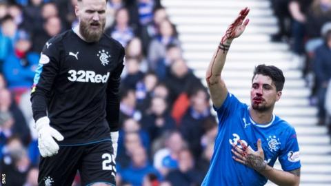 'It's not football' - Rangers' Bruno Alves unhappy with referee Steven McLean