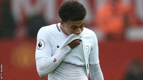 Dele Alli: England and Tottenham midfielder ruled out with hamstring injury