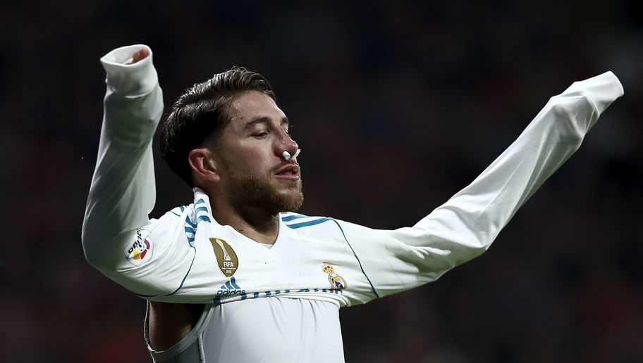 PHOTO: Sergio Ramos Reveals Graphic Picture of Gruesome Broken Nose Sustained in Madrid Derby