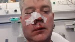 Referee's jaw broken after attack in Irish amateur league