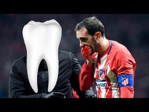 Football Players Lost Teeth During Match ? HD