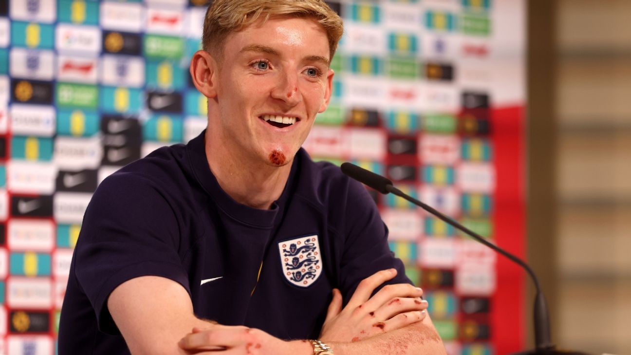 Gordon: Pressure a privilege for under-fire England