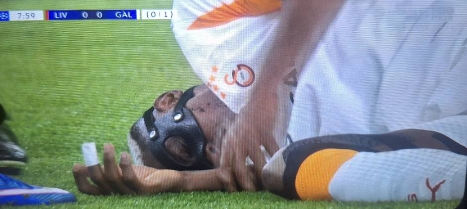 Galatasaray to Assess Osimhen for Possible Surgery After Arm Fracture